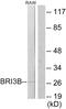 BRI3 Binding Protein antibody, PA5-38752, Invitrogen Antibodies, Western Blot image 