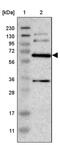 Integrin Alpha FG-GAP Repeat Containing 1 antibody, PA5-53328, Invitrogen Antibodies, Western Blot image 