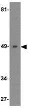 Interferon Regulatory Factor 4 antibody, GTX31438, GeneTex, Western Blot image 