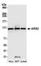 Isoleucyl-tRNA synthetase, mitochondrial antibody, A305-640A-M, Bethyl Labs, Western Blot image 