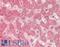 Reelin antibody, LS-B13349, Lifespan Biosciences, Immunohistochemistry paraffin image 