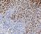 Trefoil Factor 1 antibody, A01391, Boster Biological Technology, Immunohistochemistry paraffin image 