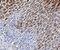 Trefoil factor 1 antibody, A01391, Boster Biological Technology, Immunohistochemistry paraffin image 