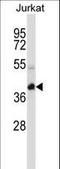 Potassium Channel Tetramerization Domain Containing 10 antibody, LS-C165455, Lifespan Biosciences, Western Blot image 