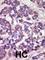 Large Tumor Suppressor Kinase 1 antibody, abx033135, Abbexa, Western Blot image 