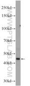 Epithelial Stromal Interaction 1 antibody, 11627-1-AP, Proteintech Group, Western Blot image 