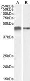 Actin Alpha 2, Smooth Muscle antibody, GTX89701, GeneTex, Western Blot image 