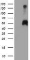 Serine Peptidase Inhibitor, Kunitz Type 1 antibody, LS-C787064, Lifespan Biosciences, Western Blot image 