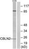 Cerebellin 2 Precursor antibody, TA316151, Origene, Western Blot image 