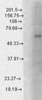 Gamma-Aminobutyric Acid Type A Receptor Beta1 Subunit antibody, GTX42019, GeneTex, Western Blot image 