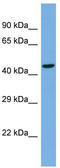 TBC1 Domain Family Member 22A antibody, TA344144, Origene, Western Blot image 