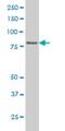 Forkhead Box E1 antibody, H00008458-M09, Novus Biologicals, Western Blot image 