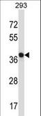 N-Terminal EF-Hand Calcium Binding Protein 1 antibody, LS-C164816, Lifespan Biosciences, Western Blot image 