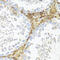 Anti-Mullerian Hormone antibody, 23-645, ProSci, Immunohistochemistry frozen image 