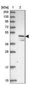 Vesicle Amine Transport 1 antibody, NBP1-92569, Novus Biologicals, Western Blot image 