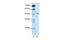 Gamma-Aminobutyric Acid Type A Receptor Beta2 Subunit antibody, 28-229, ProSci, Western Blot image 