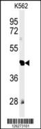 Reticulon 4 Receptor Like 1 antibody, 61-863, ProSci, Western Blot image 