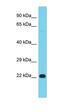 RAS Like Proto-Oncogene B antibody, orb330852, Biorbyt, Western Blot image 