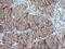 RAS Like Proto-Oncogene B antibody, M03556, Boster Biological Technology, Immunohistochemistry paraffin image 