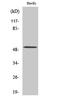 Bone Morphogenetic Protein 5 antibody, STJ91866, St John