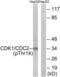 Cyclin Dependent Kinase 1 antibody, LS-C198783, Lifespan Biosciences, Western Blot image 