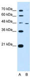Ring Finger Protein 25 antibody, TA330459, Origene, Western Blot image 