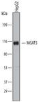 Alpha-1,6-Mannosylglycoprotein 6-Beta-N-Acetylglucosaminyltransferase antibody, MA5-24325, Invitrogen Antibodies, Western Blot image 