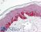 Serine/Threonine Kinase 11 antibody, LS-B592, Lifespan Biosciences, Immunohistochemistry frozen image 