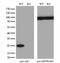 Adenylate Kinase 1 antibody, GTX84937, GeneTex, Western Blot image 