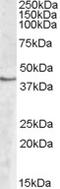 Sphingosine Kinase 1 antibody, EB08409, Everest Biotech, Western Blot image 