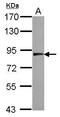Ubiquitin Specific Peptidase 33 antibody, GTX115661, GeneTex, Western Blot image 