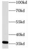 NECAP Endocytosis Associated 2 antibody, FNab05642, FineTest, Western Blot image 