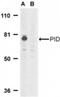 Metastasis Associated 1 Family Member 2 antibody, NBP1-76748, Novus Biologicals, Western Blot image 