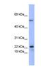 Phospholipase A2 Group V antibody, NBP1-57906, Novus Biologicals, Western Blot image 