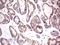 Decaprenyl Diphosphate Synthase Subunit 2 antibody, LS-C796808, Lifespan Biosciences, Immunohistochemistry paraffin image 