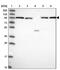 INO80 Complex Subunit D antibody, PA5-60569, Invitrogen Antibodies, Western Blot image 