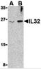 Interleukin 32 antibody, 3751, ProSci, Western Blot image 