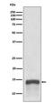 S100 Calcium Binding Protein A9 antibody, M00380-1, Boster Biological Technology, Western Blot image 