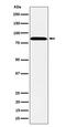 Protein Phosphatase, Mg2+/Mn2+ Dependent 1E antibody, M08794, Boster Biological Technology, Western Blot image 