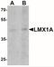 LIM Homeobox Transcription Factor 1 Alpha antibody, NBP2-41193, Novus Biologicals, Western Blot image 