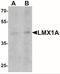 LMX1A antibody, NBP2-41193, Novus Biologicals, Western Blot image 