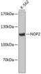 NOP2 Nucleolar Protein antibody, 14-596, ProSci, Western Blot image 