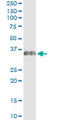 Enoyl-CoA hydratase, mitochondrial antibody, LS-C197100, Lifespan Biosciences, Immunoprecipitation image 