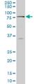 Scm Polycomb Group Protein Homolog 1 antibody, H00022955-M02, Novus Biologicals, Western Blot image 