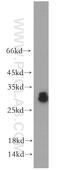 Ankyrin Repeat And SOCS Box Containing 9 antibody, 11952-1-AP, Proteintech Group, Western Blot image 