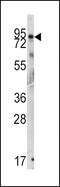 GIT ArfGAP 1 antibody, 62-895, ProSci, Western Blot image 