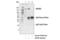 Rho Associated Coiled-Coil Containing Protein Kinase 2 antibody, 8236S, Cell Signaling Technology, Immunoprecipitation image 