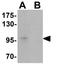 Teashirt Zinc Finger Homeobox 2 antibody, GTX31473, GeneTex, Western Blot image 