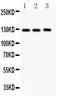 Fibulin 2 antibody, PA2159, Boster Biological Technology, Western Blot image 