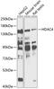 Histone Deacetylase 4 antibody, 14-502, ProSci, Western Blot image 